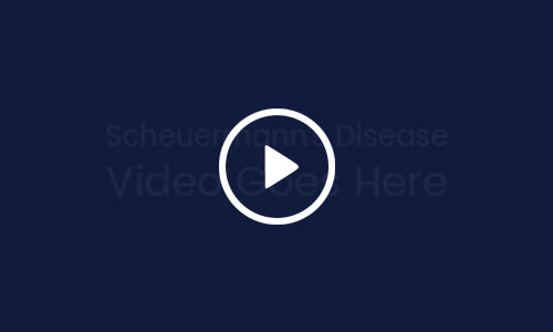 Scheuermann’s Disease