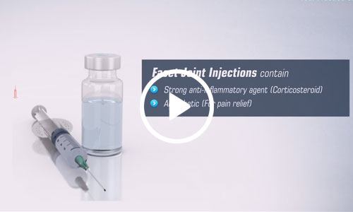 Facet Joint Injection